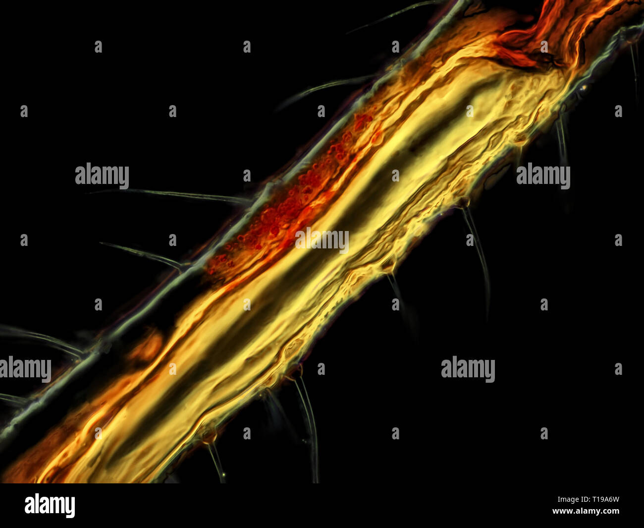 Campo scuro micrografia di luce di una gamba di afide, area raffigurato è di circa 243 micron ampia Foto Stock