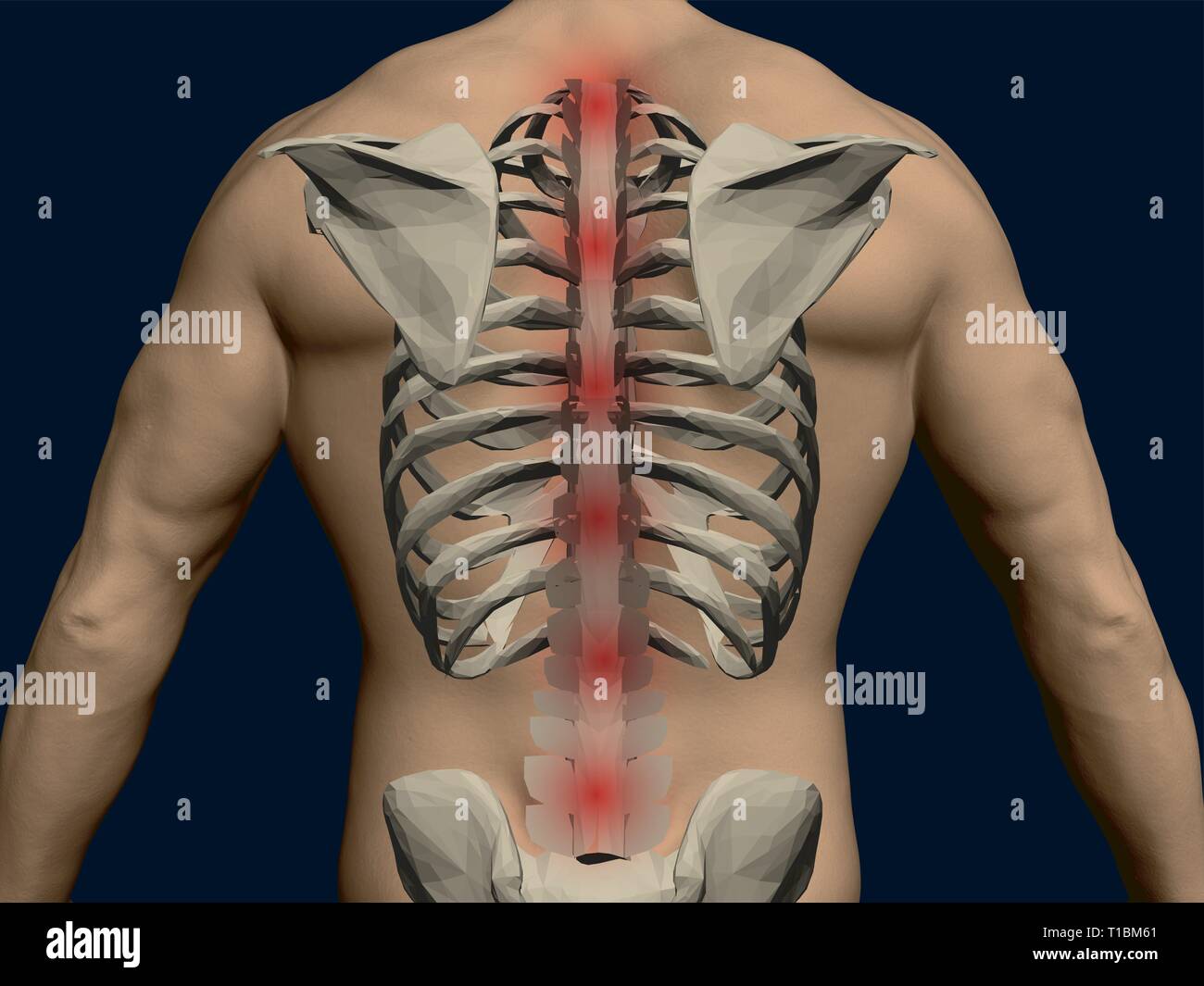 Retro del vettore di un uomo con un scheletro. Red mal di punti lungo la colonna vertebrale. 3D. Torna realistico di un uomo. Illustrazione Vettoriale Illustrazione Vettoriale