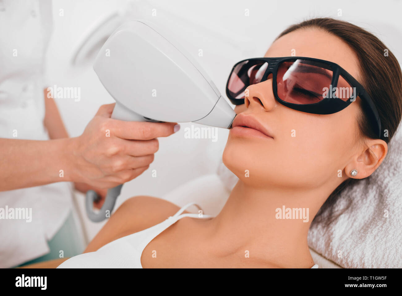 Donna ottenere di epilazione laser, la rimozione dei peli sulla zona del labbro Foto Stock