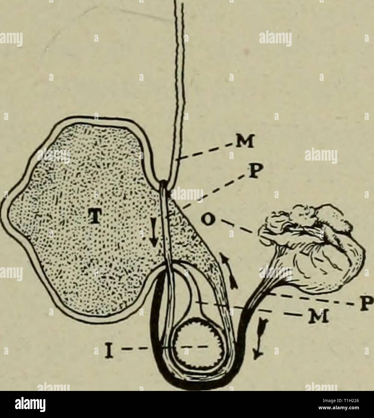 Le malattie dell'apparato genitale le malattie degli organi genitali degli animali domestici diseasesofgenita01sarà Anno: 1921 tumori benigni dei genitali femminili 261 ubicazione, anteriore all'apice uterino cornu quando grandi tumori ovarici cause incarcerazione colica, la diagno- sis non è sempre facile. Se il carcere comporta il pel- vic porzione del retto, il veterinario si trova di fronte a un piuttosto delicato problema nella diagnosi. Egli non può palpare l'utero e ovaie per vaginam, egli può trovare la palpazione al retto bloccato di incarcerazione. La questione principale è compreso tra una stenosi del t Foto Stock