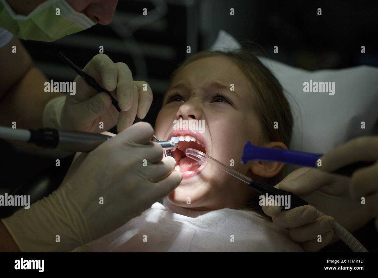 Spaventata bambina presso l ufficio di dentisti, nel dolore durante un trattamento. Pazienti pediatrici la cura dentale e la paura del dentista concetto. Foto Stock