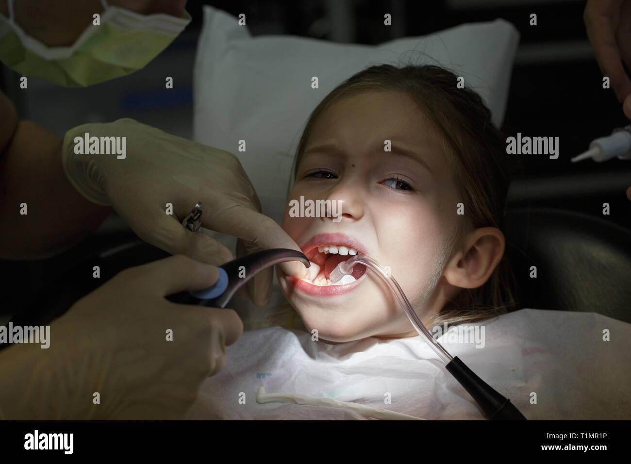 Spaventata bambina presso l ufficio di dentisti, nel dolore durante un trattamento. Pazienti pediatrici la cura dentale e la paura del dentista concetto. Foto Stock
