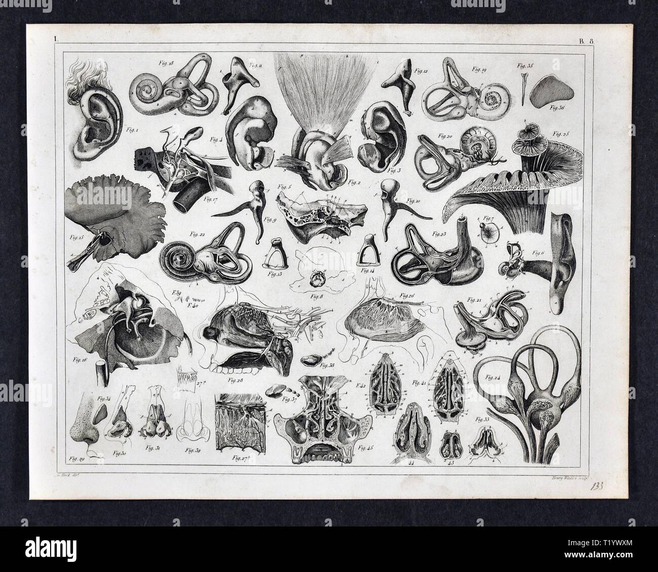 1849 Illustrazione medica di Anatomia Umana delle orecchie, naso e gola Foto Stock