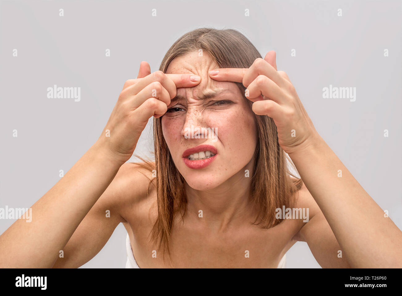irritazione sulla fronte
