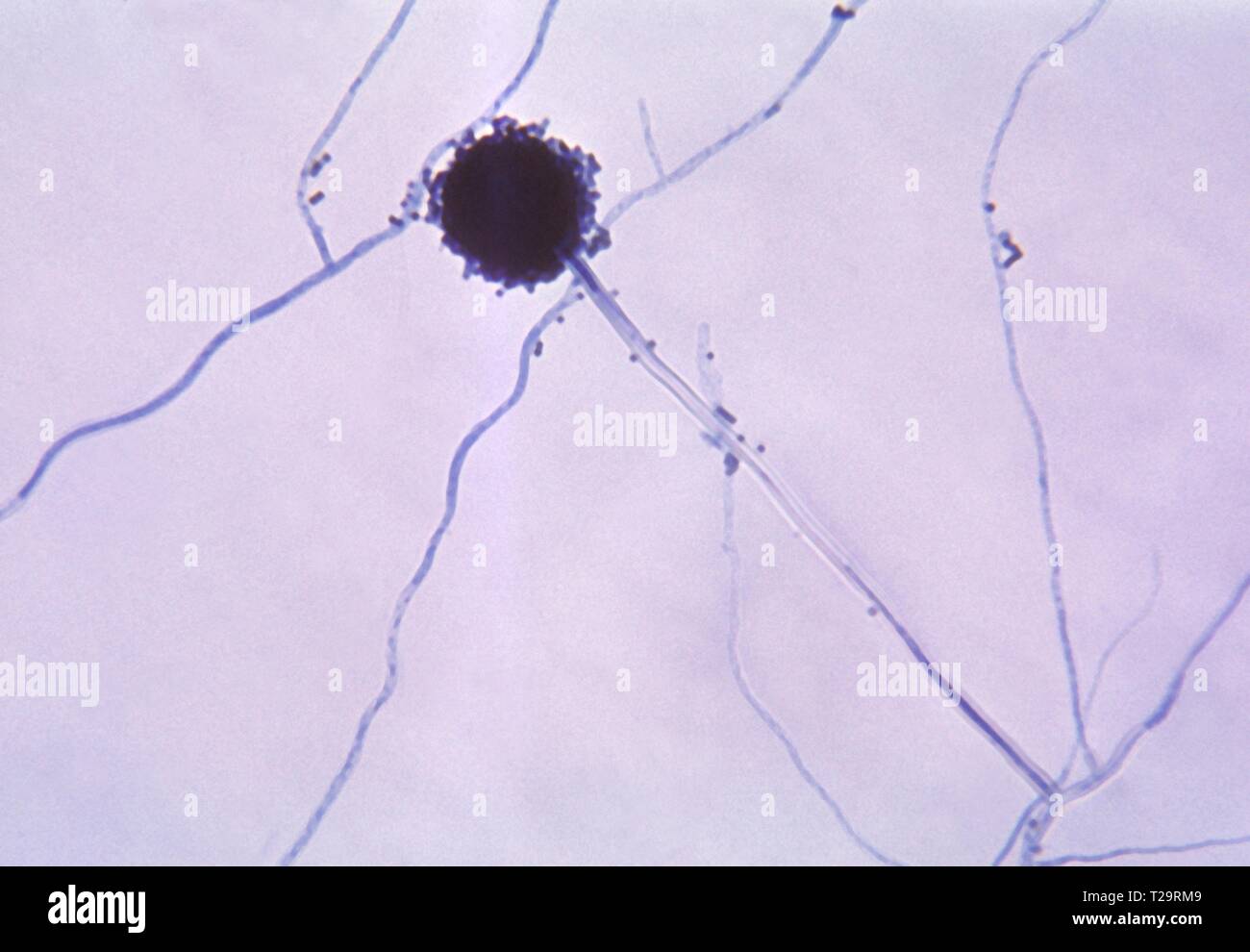 La fotomicrografia della testa conidial di Aspergillus niger fungo, 1955. Immagine cortesia di centri per il controllo e la prevenzione delle malattie (CDC) / Dr Lucille K. Georg. () Foto Stock