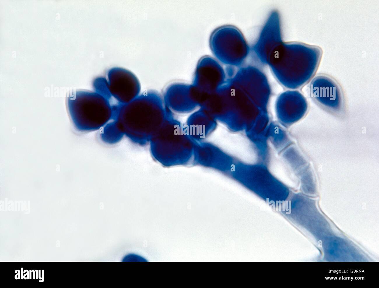 La fotomicrografia di Botrytis specie fungina (muffa grigia), mostrando ai cluster di spora asessuata-contenenti conidi, 1955. Immagine cortesia di centri per il controllo e la prevenzione delle malattie (CDC) / Dr Lucille K. Georg. () Foto Stock