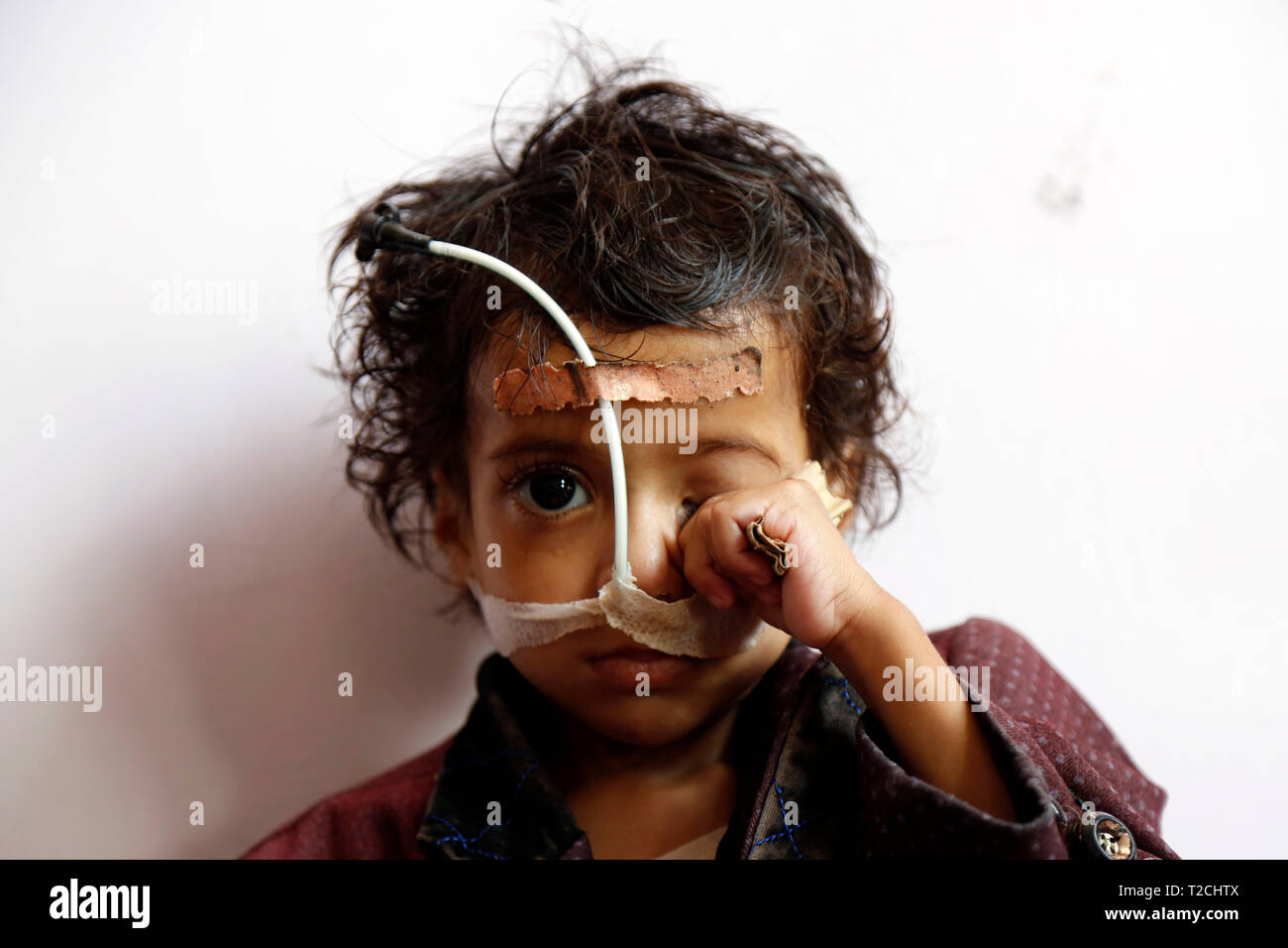Sanaa, Yemen. 1 apr, 2019. Un bambino malnutriti si siede sul letto come egli riceve un trattamento medico a una malnutrizione care Center in Sanaa, Yemen, il 1 aprile 2019. Secondo il Fondo delle Nazioni Unite per l'Infanzia (UNICEF), circa 394,000 yemenita per i bambini sotto i 5 anni soffrono di malnutrizione severa acuta e necessità di trattamento. Credito: Mohammed Mohammed/Xinhua/Alamy Live News Foto Stock