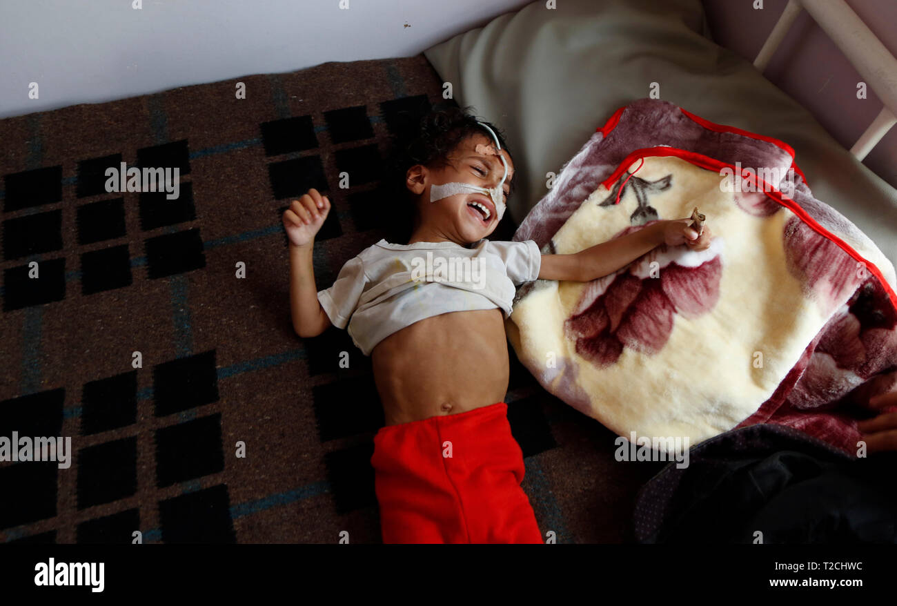 Sanaa, Yemen. 1 apr, 2019. Un bambino malnutriti risiede nel letto come egli riceve un trattamento medico a una malnutrizione care Center in Sanaa, Yemen, il 1 aprile 2019. Secondo il Fondo delle Nazioni Unite per l'Infanzia (UNICEF), circa 394,000 yemenita per i bambini sotto i 5 anni soffrono di malnutrizione severa acuta e necessità di trattamento. Credito: Mohammed Mohammed/Xinhua/Alamy Live News Foto Stock