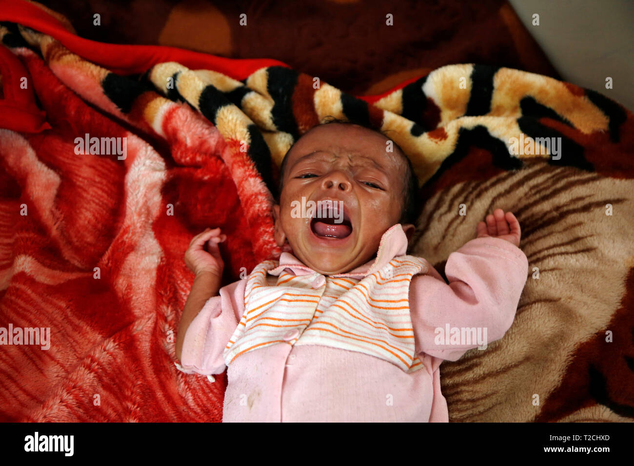 Sanaa, Yemen. 1 apr, 2019. Un bambino malnutriti grida a una malnutrizione care Center in Sanaa, Yemen, il 1 aprile 2019. Secondo il Fondo delle Nazioni Unite per l'Infanzia (UNICEF), circa 394,000 yemenita per i bambini sotto i 5 anni soffrono di malnutrizione severa acuta e necessità di trattamento. Credito: Mohammed Mohammed/Xinhua/Alamy Live News Foto Stock