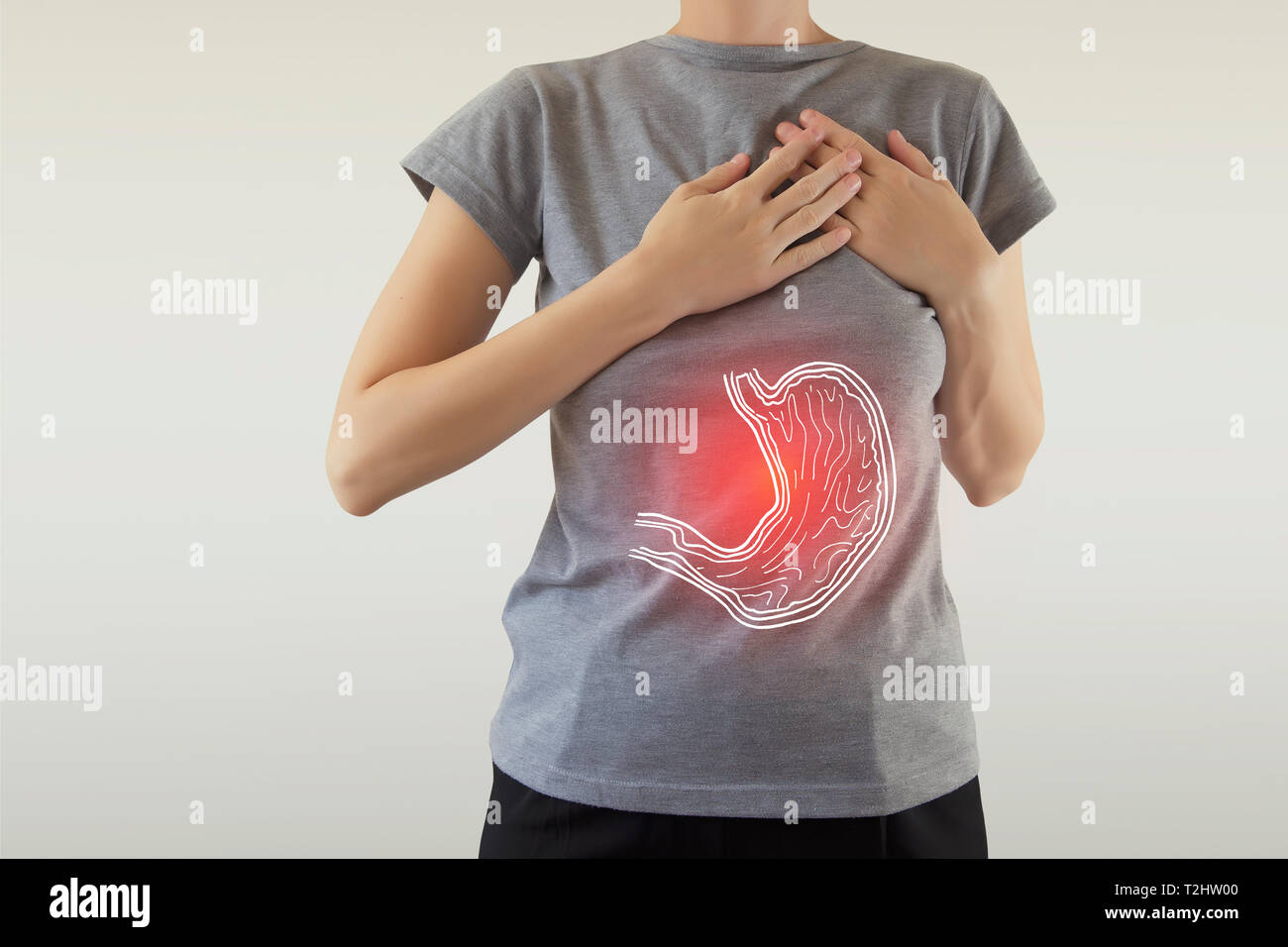 Evidenziato in rosso nello stomaco / organo lesa / Biomedicale illustrazione Foto Stock