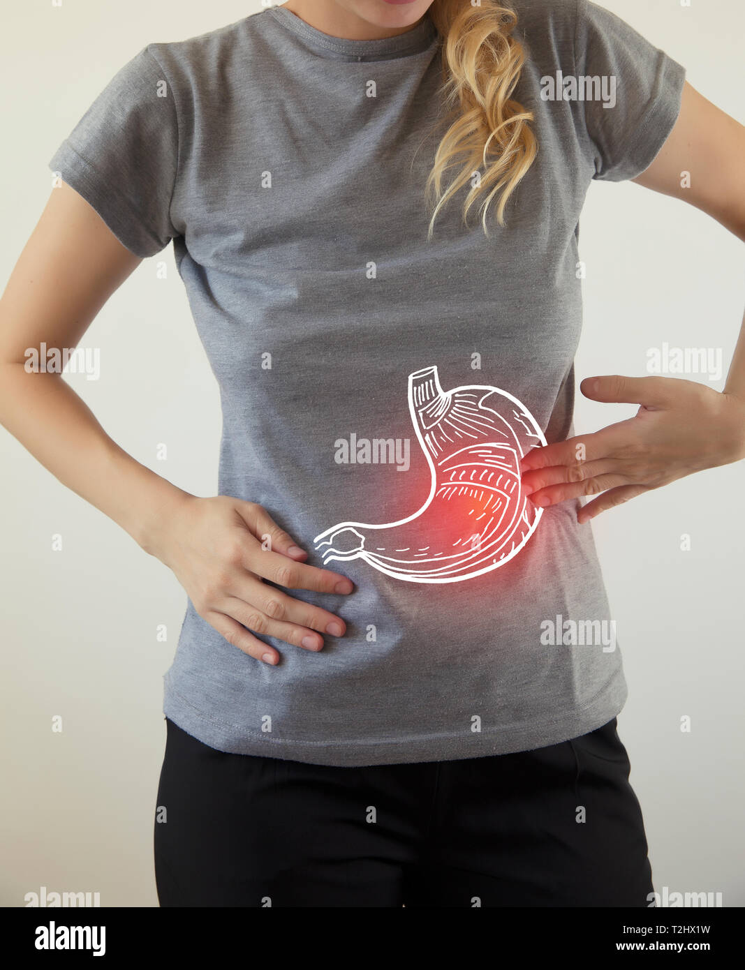 Evidenziato in rosso nello stomaco / organo lesa / Biomedicale illustrazione Foto Stock