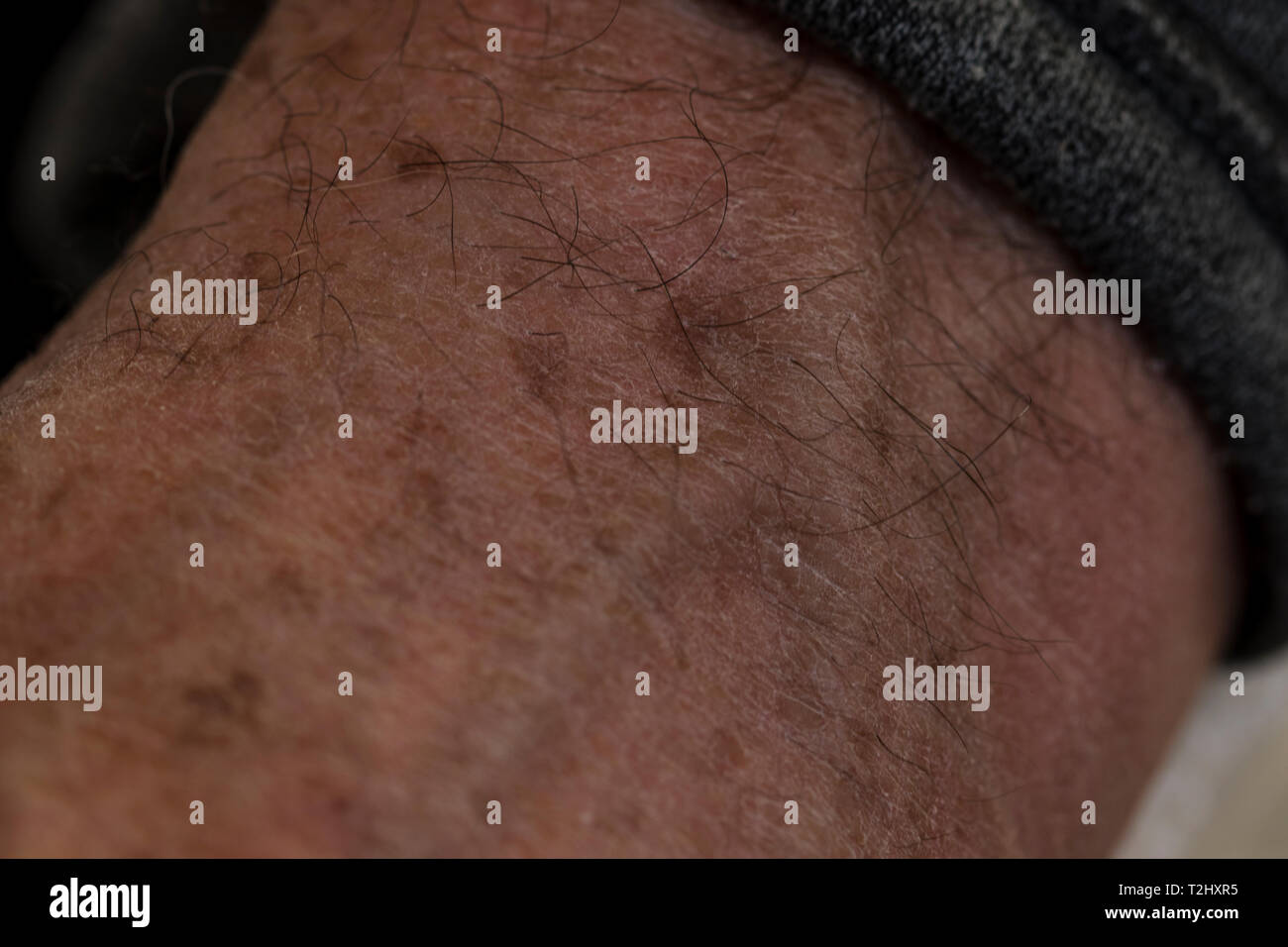 Le macchie solari e fegato macchie sulla pelle di un vecchio mans mani Foto  stock - Alamy