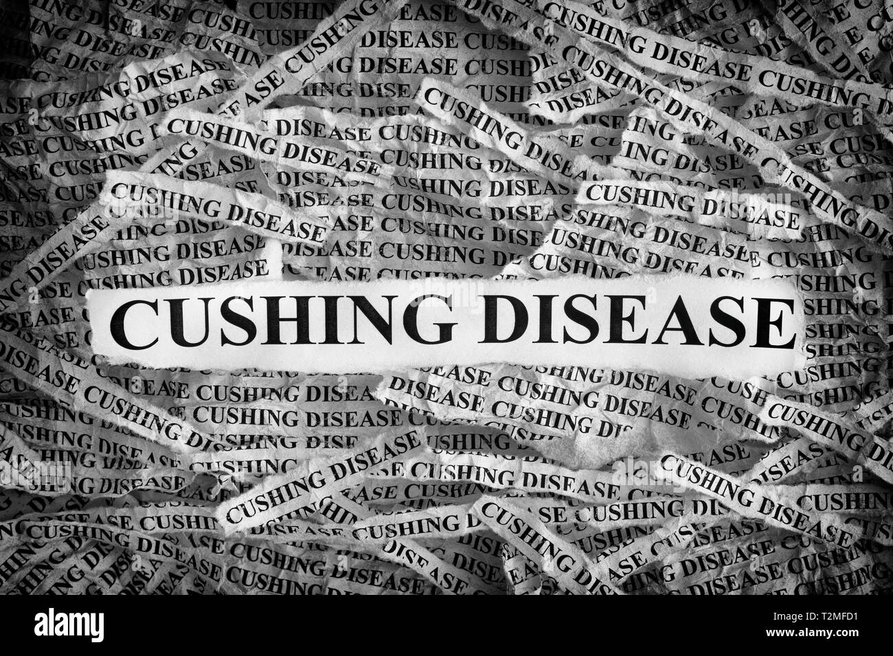 Cushing malattia. Pezzi di carta strappati con le parole Cushing malattia. Concetto di immagine. In bianco e nero. Close up. Foto Stock