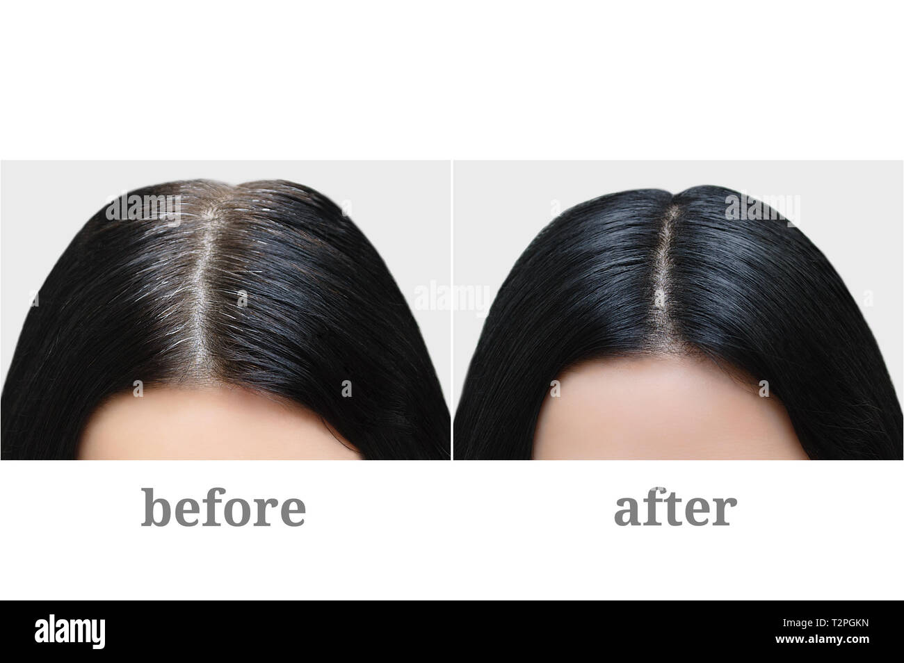 Testa di una ragazza con il nero capelli grigi. La colorazione dei capelli. Prima e dopo. Foto Stock