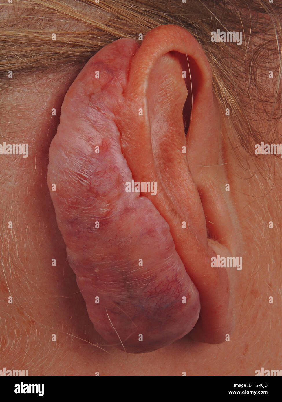 Orecchio Foto Stock