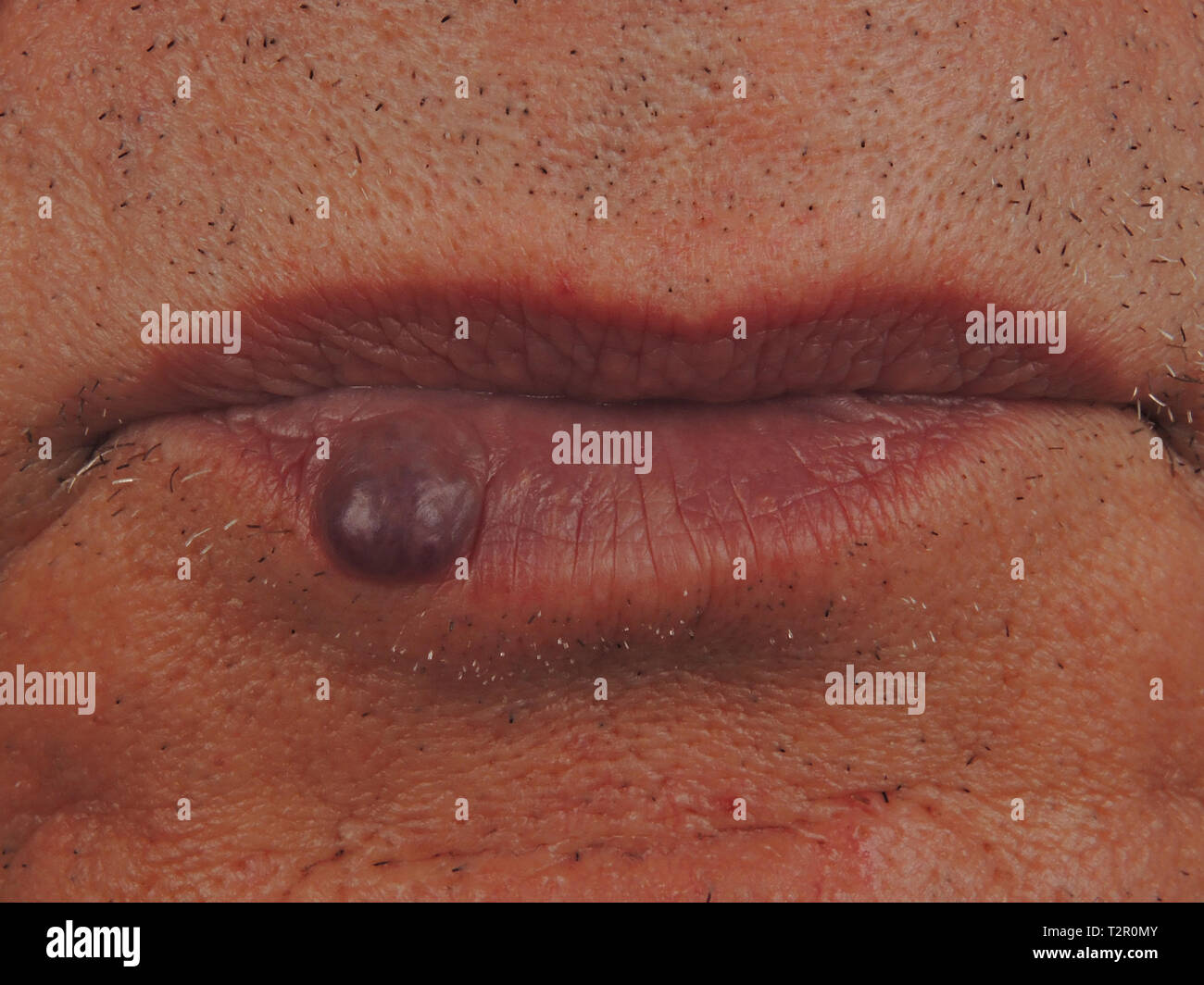 Sangue delle labbra immagini e fotografie stock ad alta risoluzione - Alamy