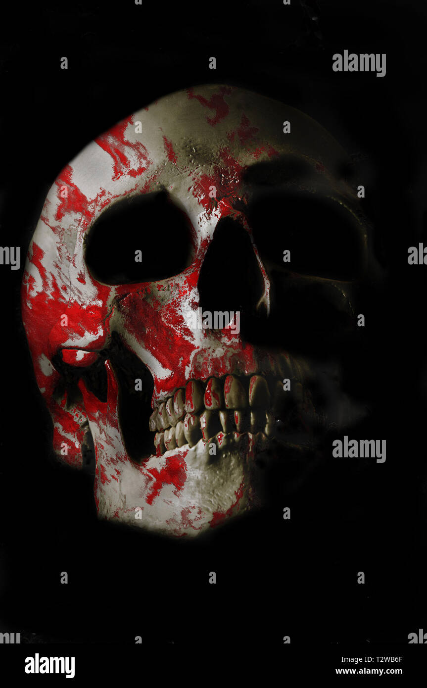Cranio umano macchiato di sangue Foto Stock