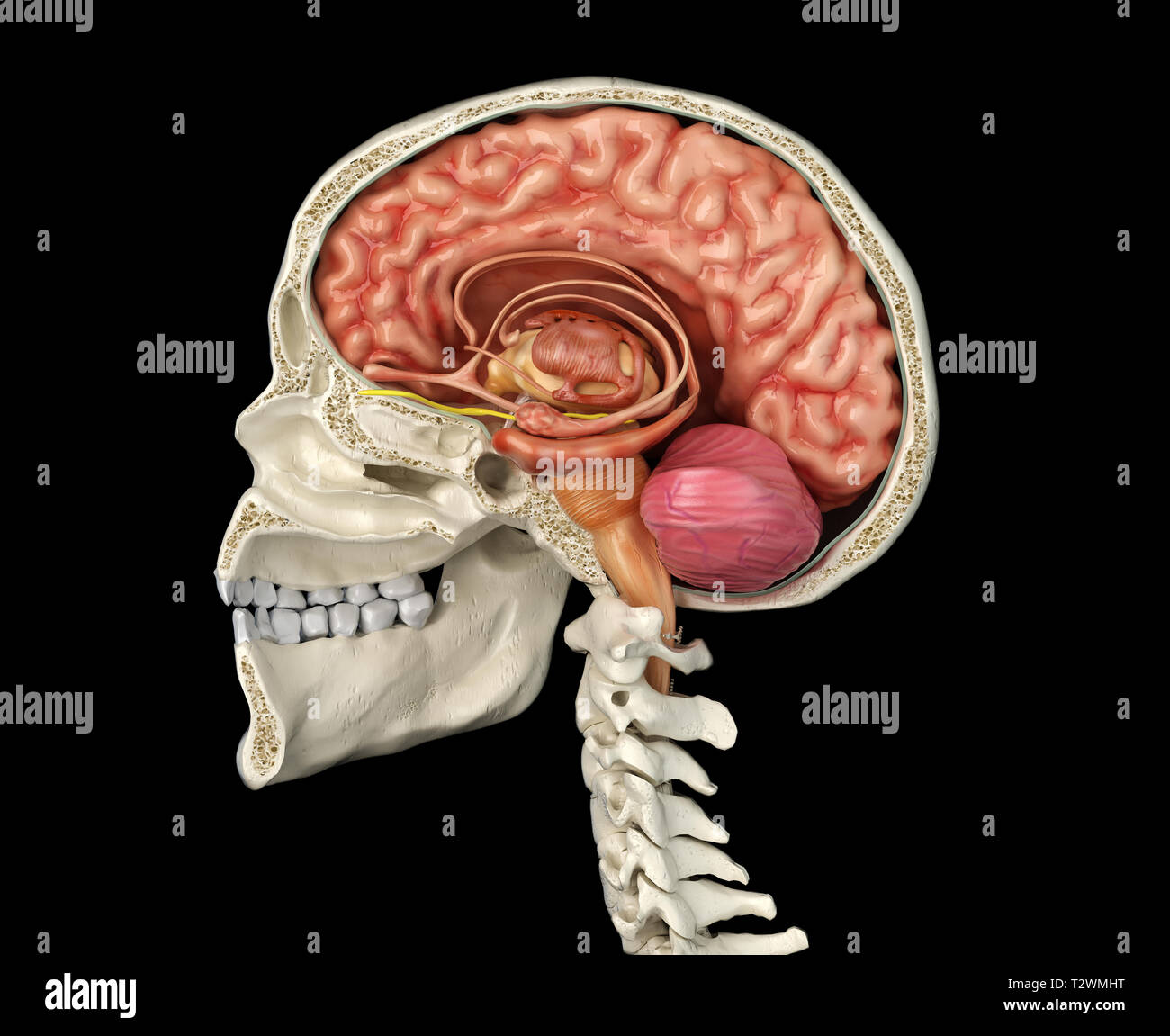 Cranio umano sagittale metà sezione con il cervello. Vista laterale su sfondo nero. Foto Stock