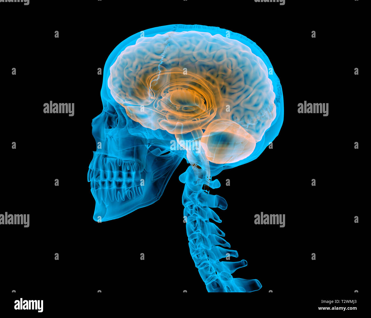 Cranio umano con il cervello. X-ray effetto. Vista laterale su sfondo nero. Foto Stock