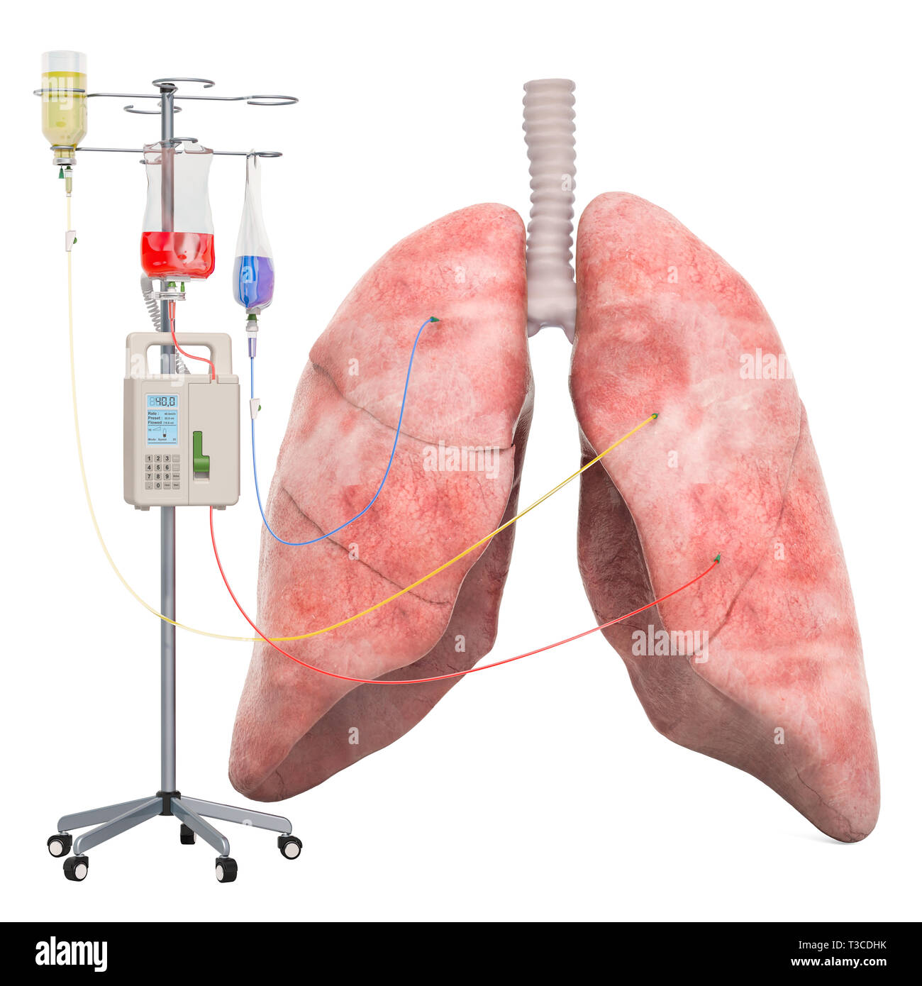 Terapia endovenosa con sistema di polmone umano. Il trattamento di una malattia polmonare concetto, 3D rendering isolati su sfondo bianco Foto Stock