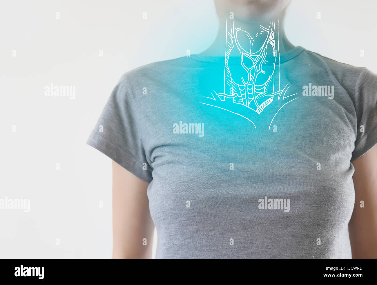 Gola femmina con evidenziato il dolore / infezione influenzale Foto Stock