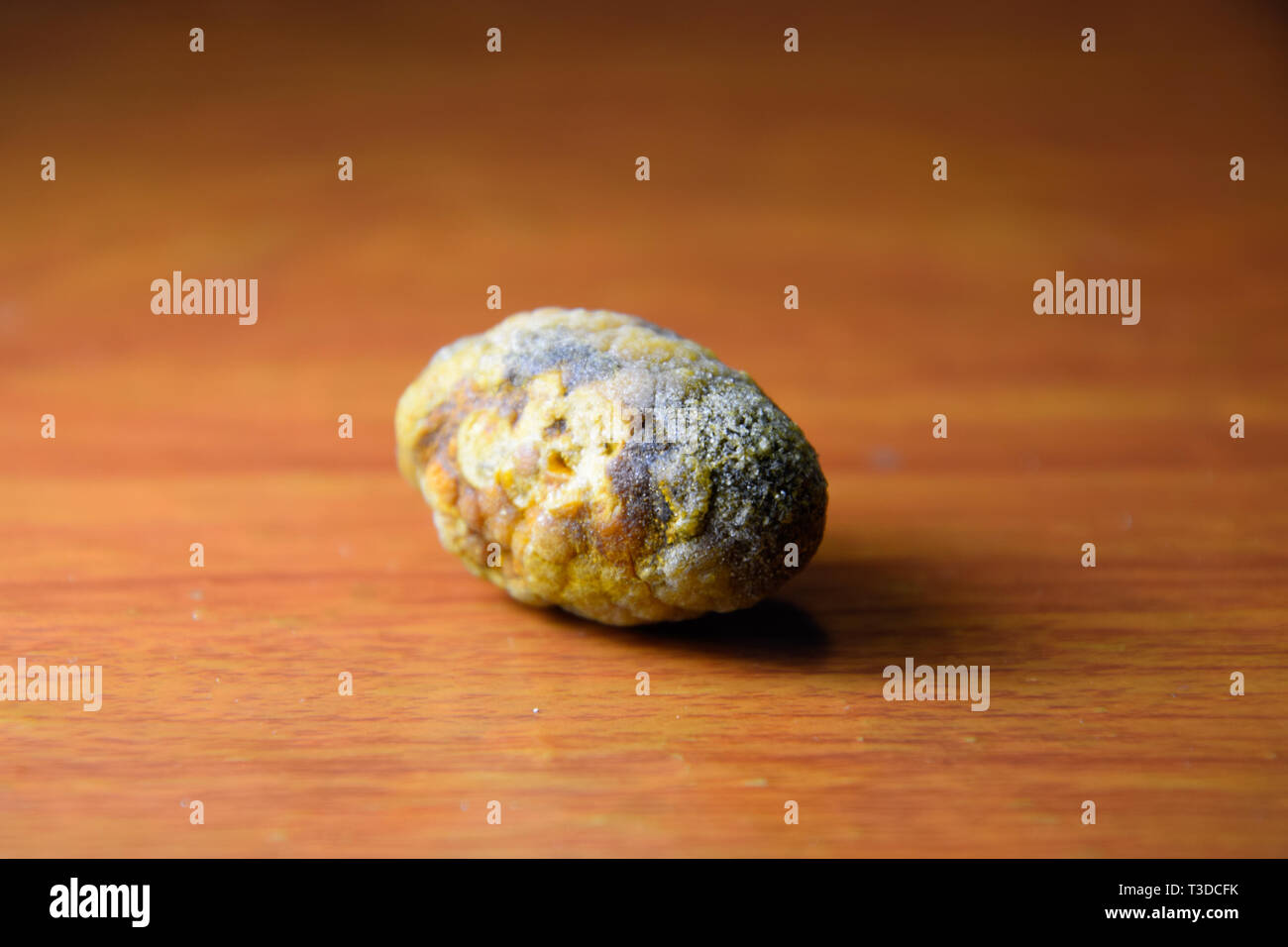 Grandi gallstone, cistifellea pietre. Il risultato dei calcoli biliari. Un calcolo di composizione eterogenea su uno sfondo marrone Foto Stock