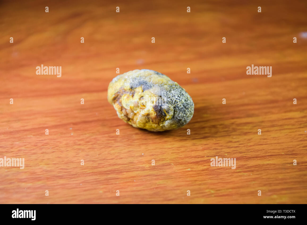 Grandi gallstone, cistifellea pietre. Il risultato dei calcoli biliari. Un calcolo di composizione eterogenea su uno sfondo marrone Foto Stock