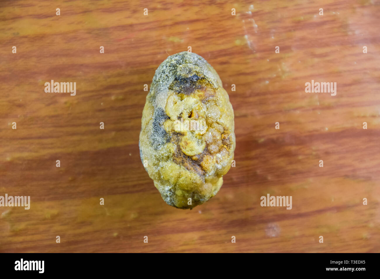 Grandi gallstone, cistifellea pietre. Il risultato dei calcoli biliari. Un calcolo di composizione eterogenea su uno sfondo marrone Foto Stock
