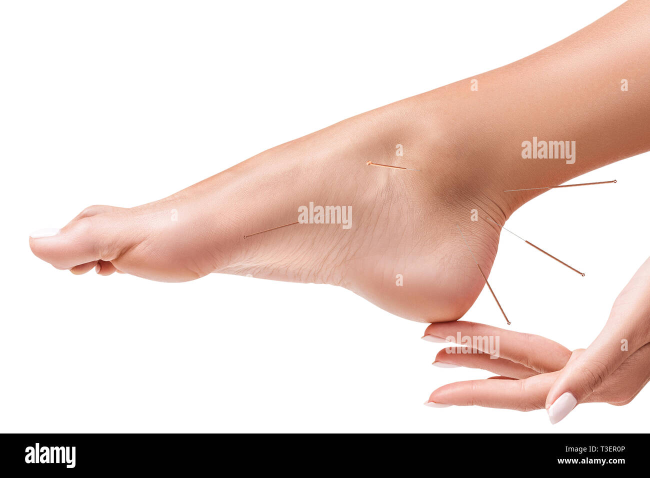 Gambe femmina con inserto aghi di agopuntura. Foto Stock