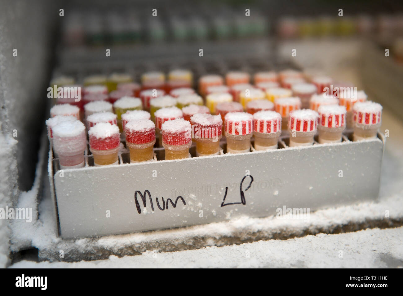 I campioni di medicinali all'interno di un congelatore nei laboratori ai bambini del 90s, leader mondiale di coorte di nascita studio, charting la salute di 14.500 famiglie nell'area di Bristol, in base all'Università di Bristol Study Centre di Bristol. Foto Stock