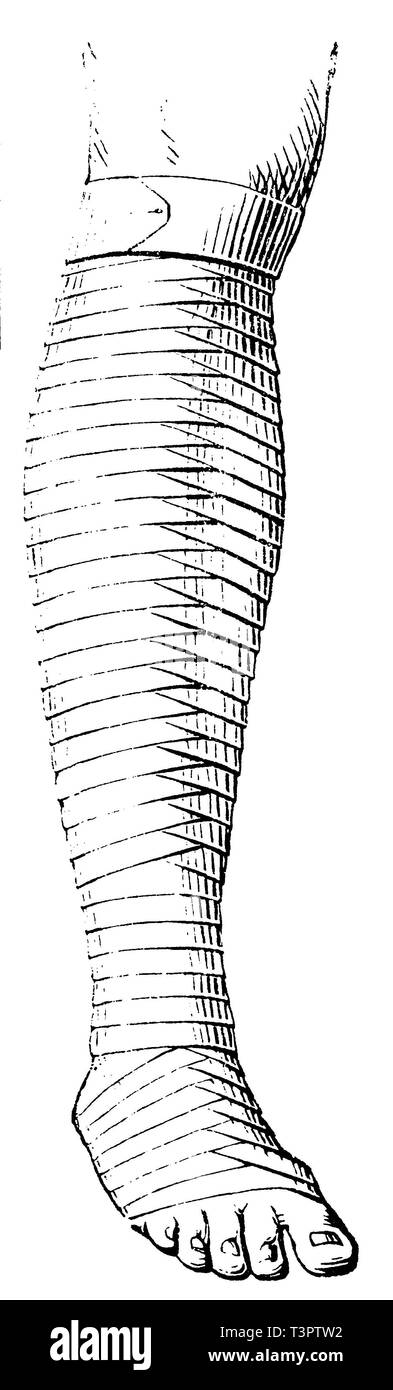 Bendaggio della parte inferiore della gamba, anonym 1887 Foto Stock