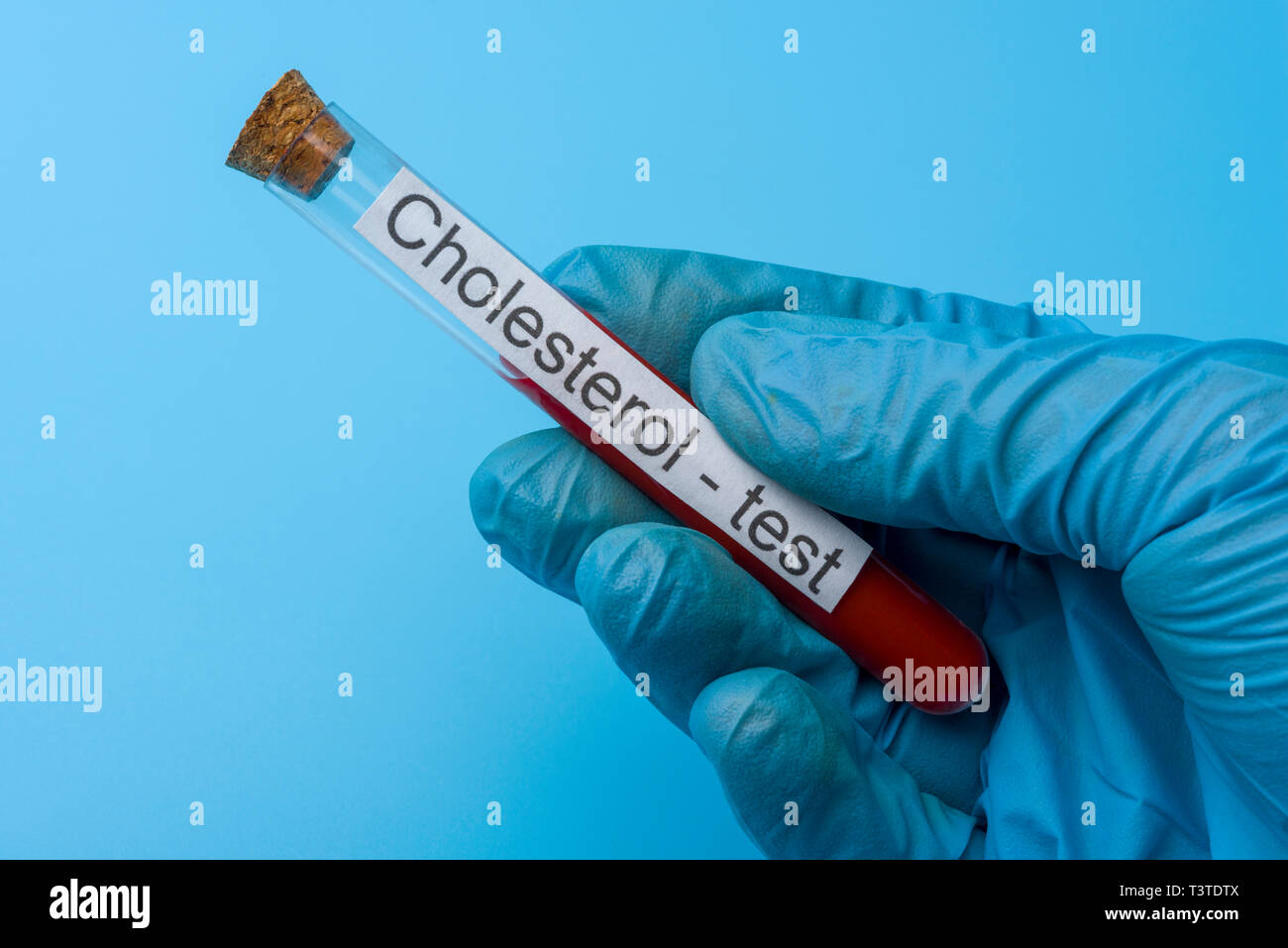 Mano che tiene una prova di colesterolo in un tubo di prova su uno sfondo blu. Il concetto di medicina e di analisi. Foto Stock