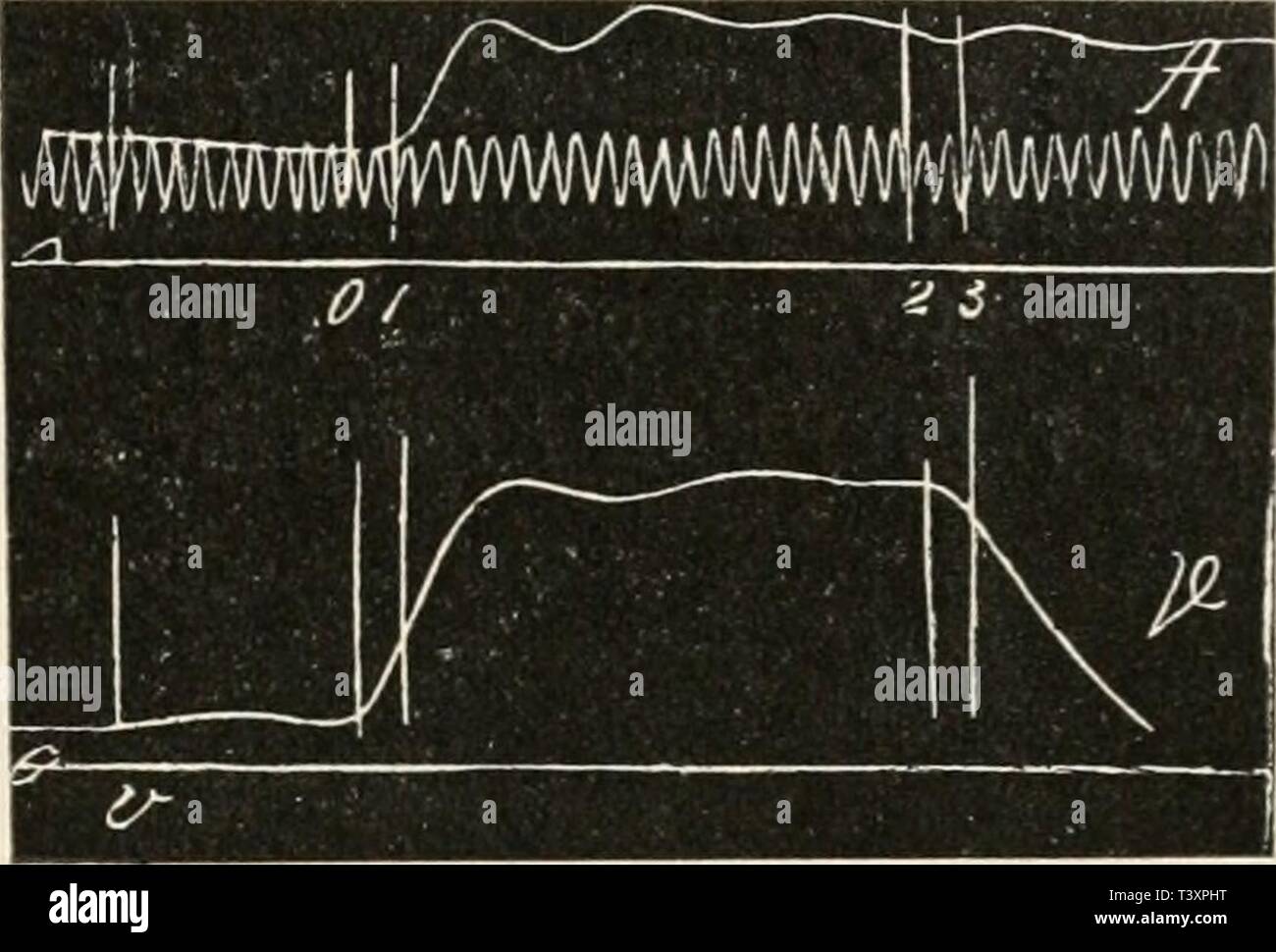 Immagine di archivio da pagina 142 di Die Physiologie des Kreislaufes (1921). Die Physiologie des Kreislaufes diephysiologiede01tige Anno: 1921 Fig. 89. Intrakardiale Druck- kurve, linke Kammer, Hund. Nach Fredericq. Fig. 90. Druckkurven aus der Aorta {A) und der linken Kammer {V), Hund. Nach Hiirthle. Hierher gehören auch die von Patterson, Piper und Starling wie von H.Straub am Kreislauf vereinfachten nach Starling (vgl. Kap. XII) gewonnenen Kurven des Druckes intrakardialen (vgl. Fig. 95). Die zweite Gruppe der intrakardialen Druckkurven wird vor allem durch die von v. Frey und Krehl (Fig. 96), Foto Stock