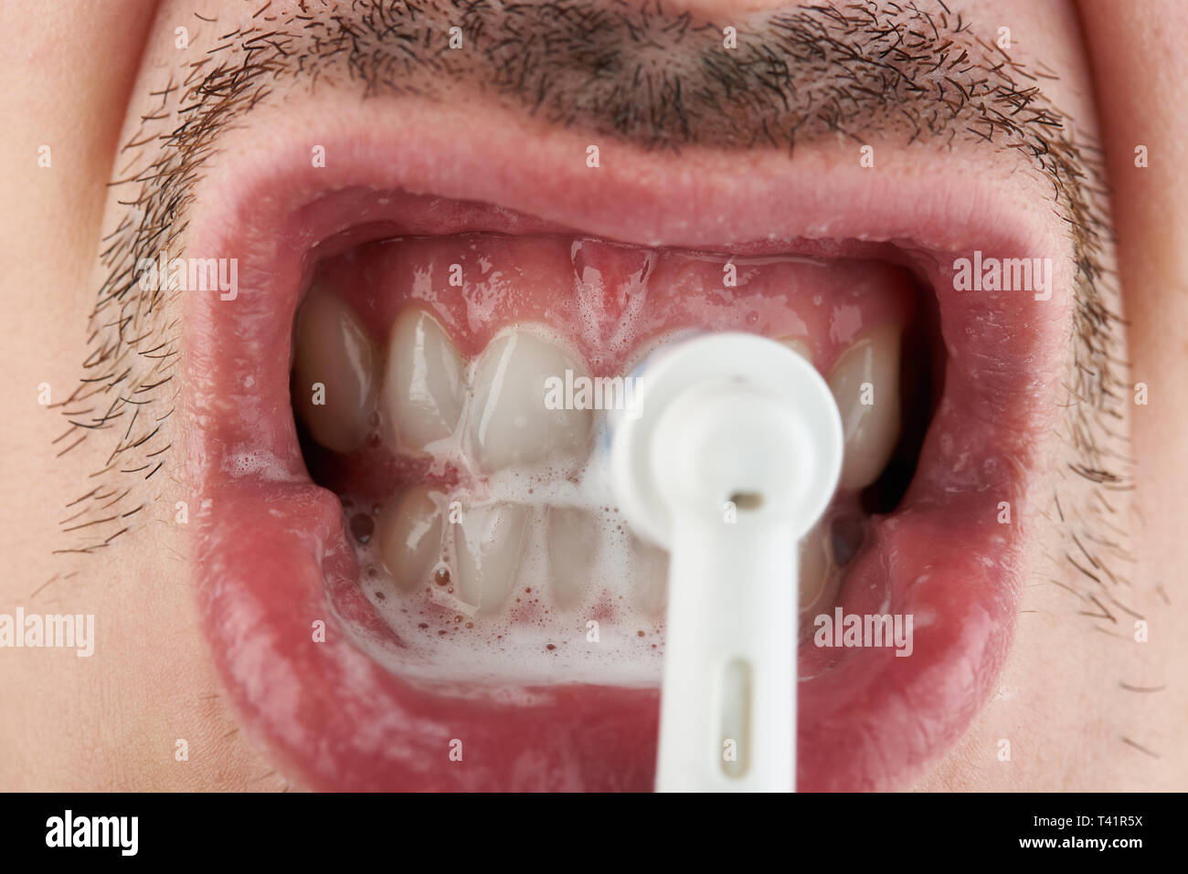 Lucidare denti bianchi macro vista ravvicinata Foto Stock
