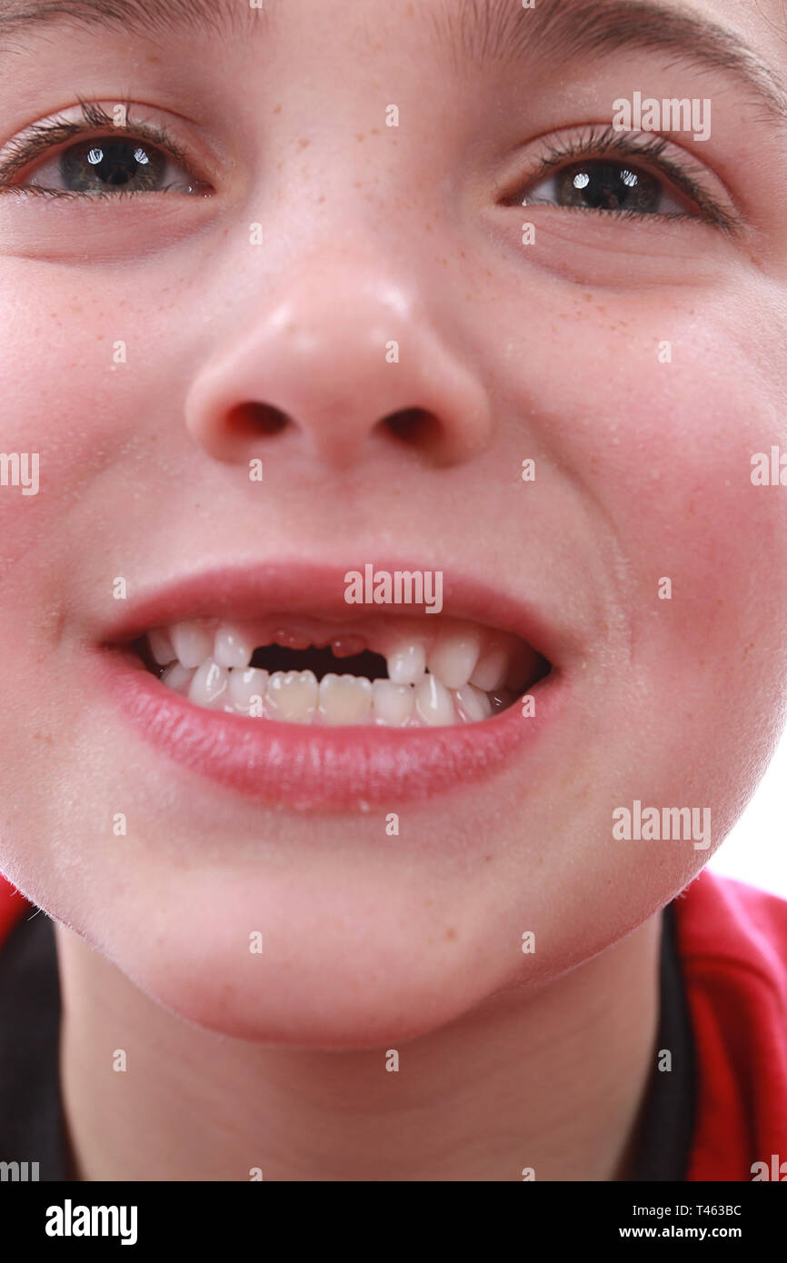 La perdita dei denti, bambino igiene dentale Foto Stock
