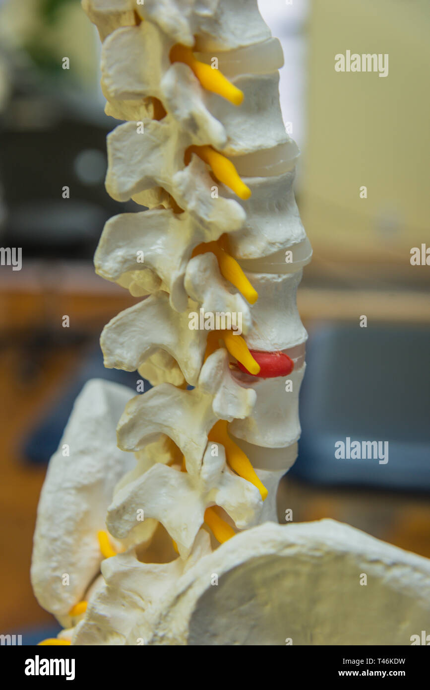 Modello della colonna vertebrale umana i dischi e i nervi Foto Stock