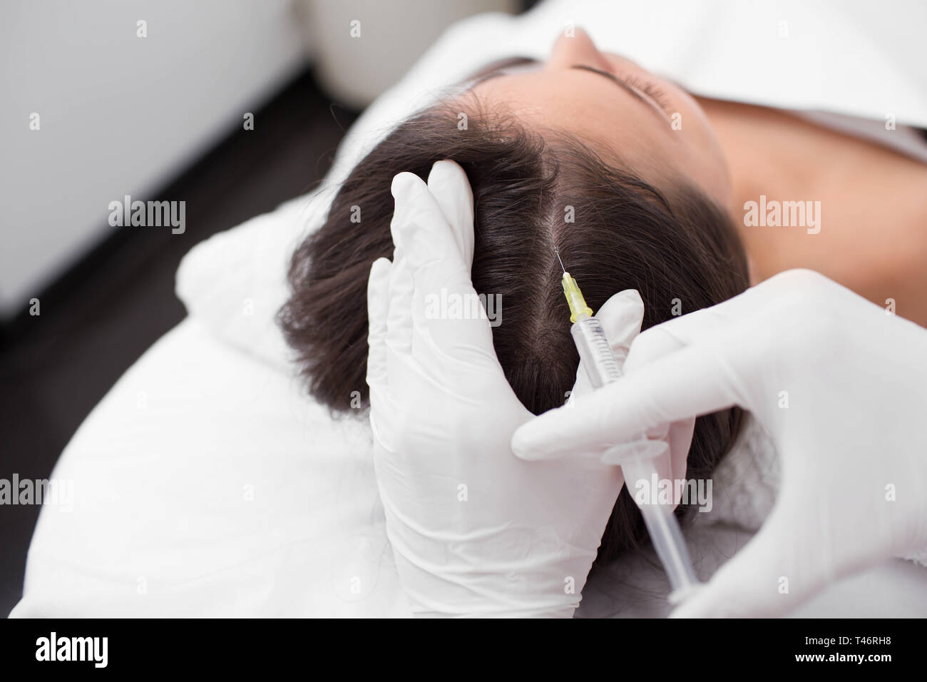 Il trattamento della perdita di capelli, iniezione per la crescita dei capelli. Iniettato nella testa di donna, capelli mesoterapia Foto Stock