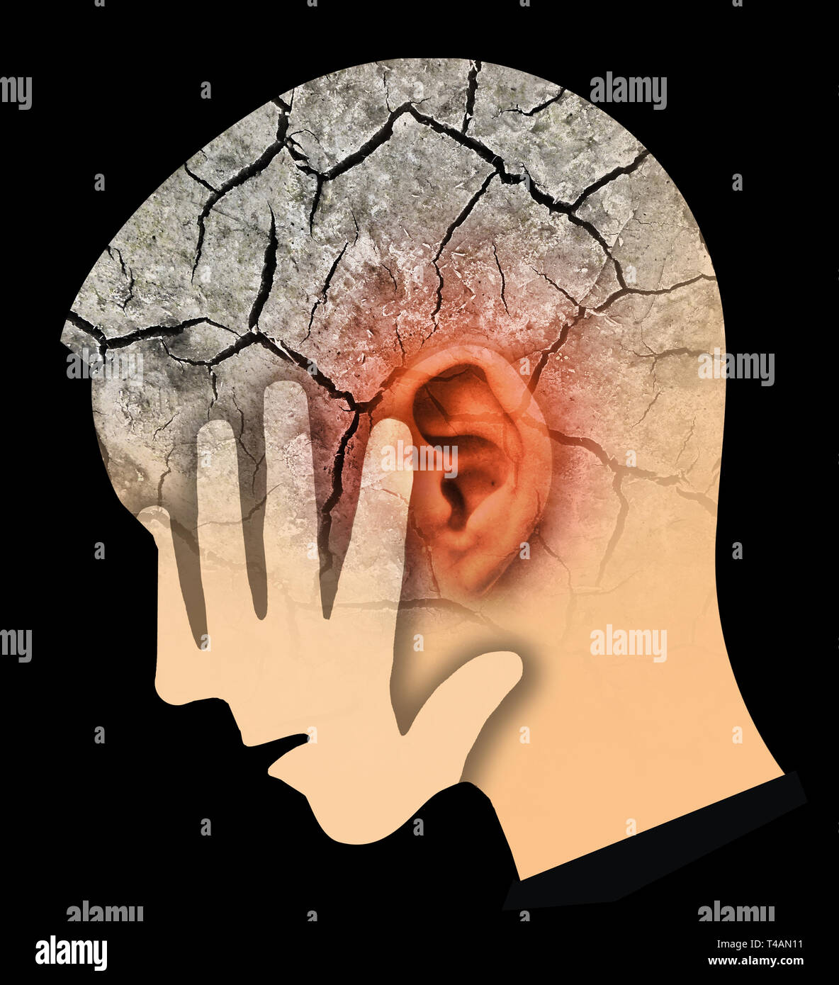 Uomo con big red incrinato orecchio e testa, che simboleggiano il tinnito e problemi alle orecchie. Testa maschio profilo stilizzato. Fotomontaggio a secco con massa rotto. Foto Stock