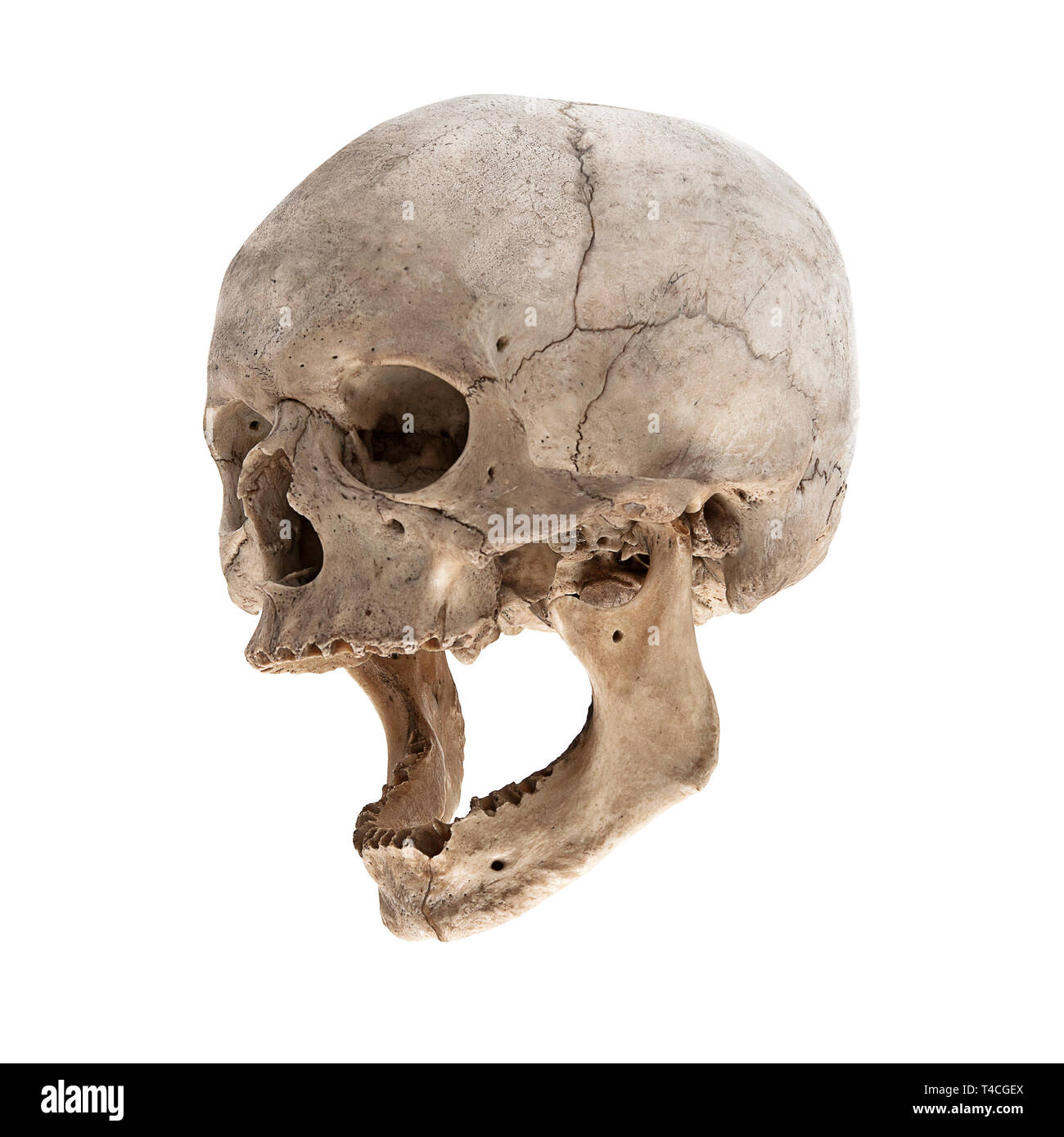 Un vecchio teschio umano con una ganascia Foto Stock