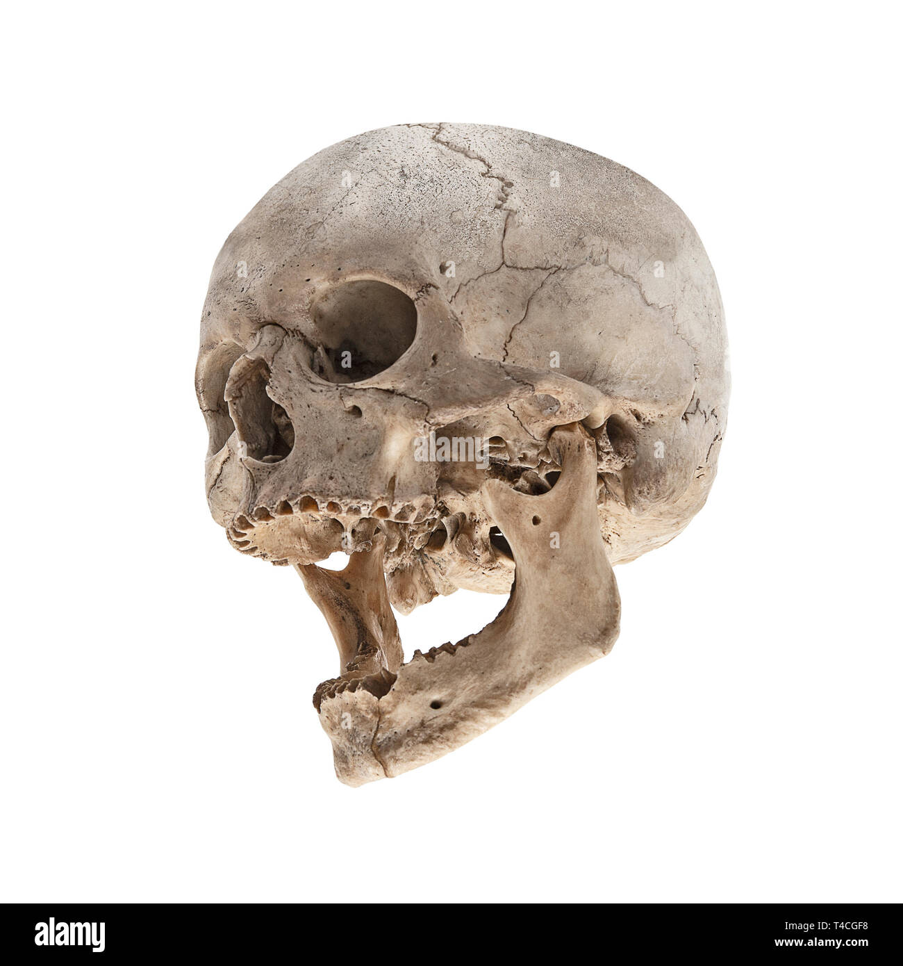 Un vecchio teschio umano con una ganascia senza denti Foto Stock