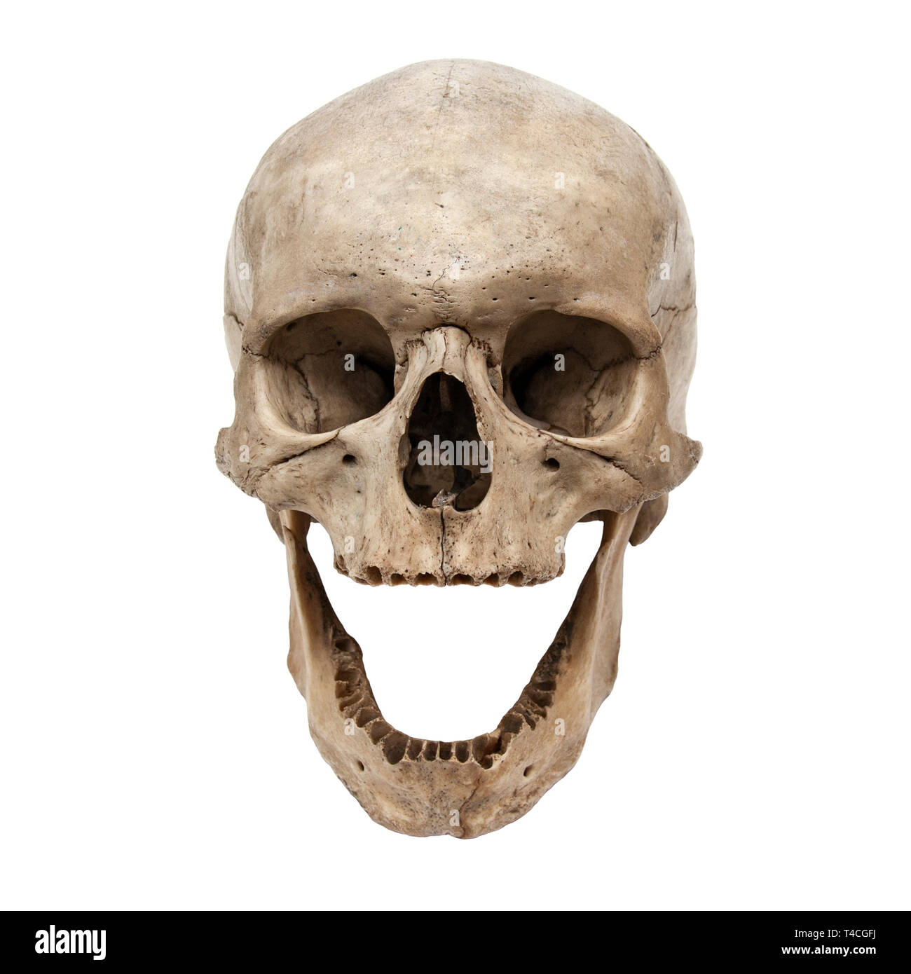 Il vecchio teschio umano vista anteriore senza denti Foto Stock