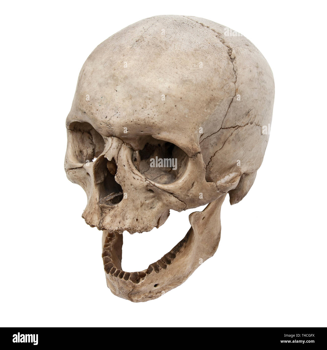 Il vecchio teschio umano vista da sopra con n. di denti Foto Stock