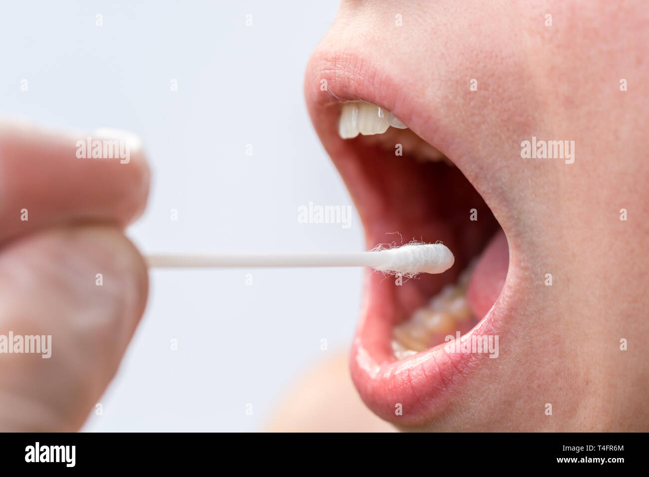 Test della Saliva sulla bocca con tamponi di cotone come un banco di prova per le varie malattie Foto Stock