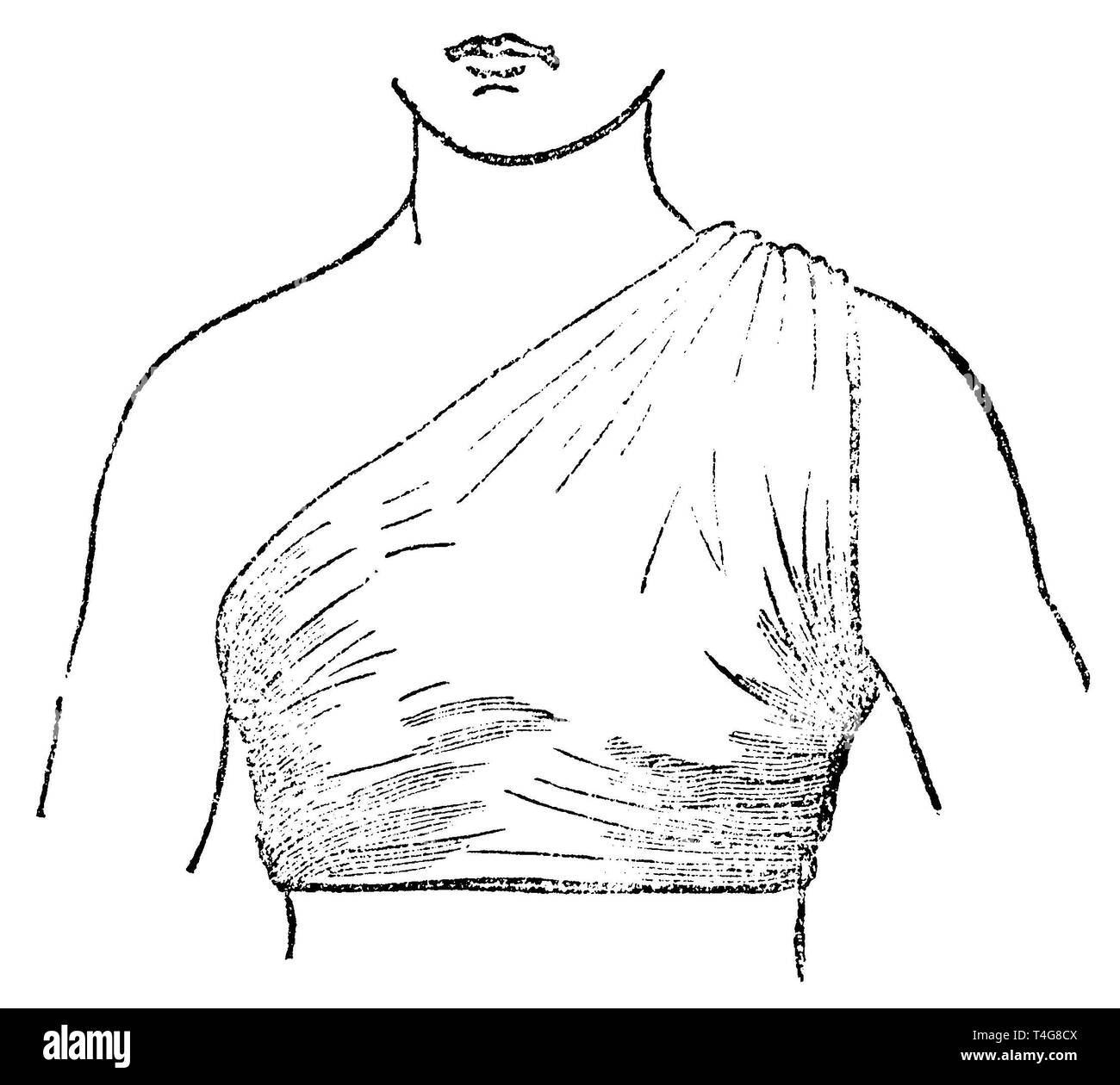 Sciarpa triangolare bendaggio, anonym 1887 Foto Stock