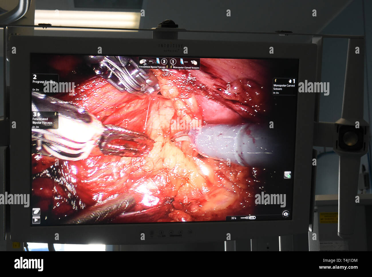 Leipzig, Deutschland. 20 Mar, 2019. 20.03.2019, Sassonia, Lipsia: nel centro di trapianto presso l'ospedale universitario, un team chirurgico dal reparto di urologia prende un rene da un donatore sano con l aiuto di Da Vinci sistema robotizzato per il trapianto. Nel centro Transpantation, che è stata fondata nel 1993, più di 1040 i fegati e oltre mille i reni potrebbero essere trapiantate negli ultimi venticinque anni. Credito: Waltraud Grubitzsch/dpa-Zentralbild/ZB | in tutto il mondo di utilizzo/dpa/Alamy Live News Foto Stock