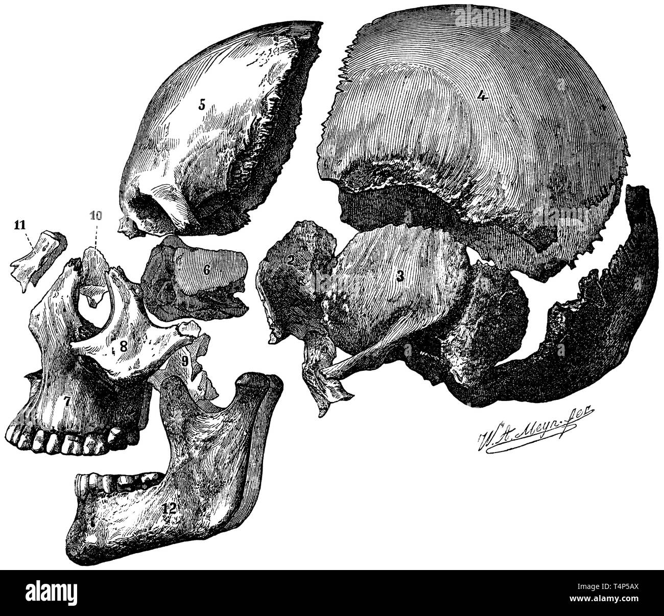 Macchiato il cranio di un adulto di sesso maschile, visto dal lato sinistro. 1) osso occipitale, 2) sphenoid, separato da esso da sega, 3) osso temporale, 4) ossa parietali, 5) osso frontale, 6) ethmoidal osso, 7) osso mascellare, 8) osso zigomatico, 9) osso palatale, 10) Gamba di lacerazione, 11) osso nasale , 12) dell'osso mandibolare, W.A. Meyn fec. 1887 Foto Stock