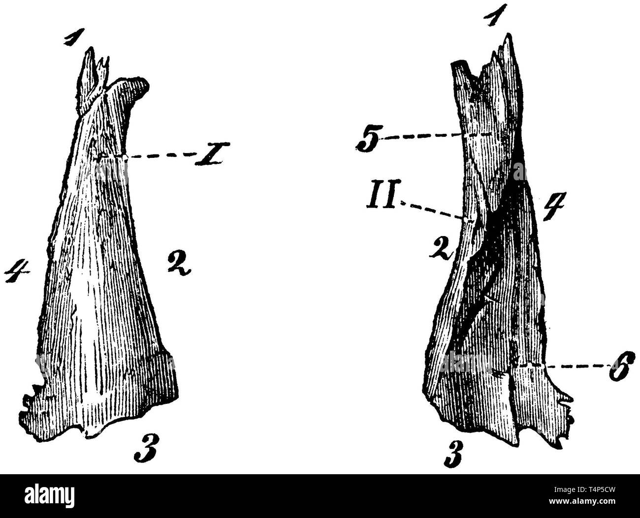 Naso gambe: I) dall'esterno, II) visto dall'interno. 1) superiore, 2) medio, inferiore 3a, 4a bordo laterale, 5) superiore, 6) la parte inferiore della superficie interna. A 6) solco per la sinusite etmoide nervo, anonym 1887 Foto Stock