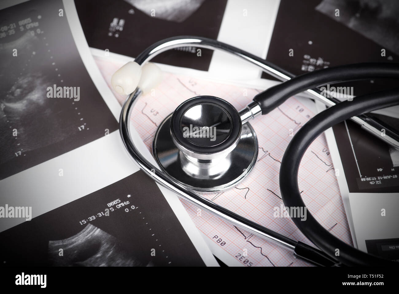 Prova medica - uno stetoscopio ad ultrasuoni e shot cardiogram Foto Stock