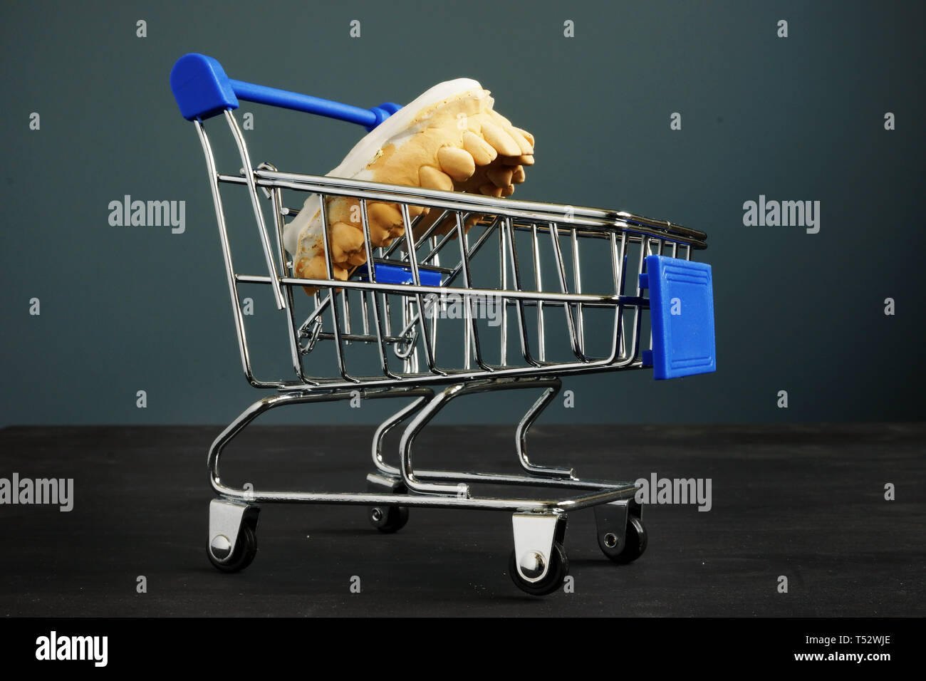 Piano dentale e il costo del trattamento. Denti modello colato in un carrello della spesa. Foto Stock