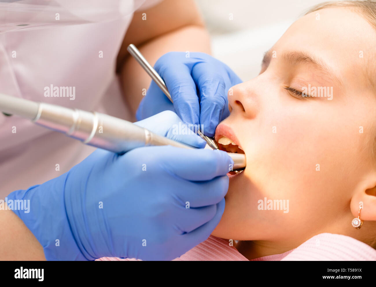 Dentista dentale di eseguire la procedura di rifornimento per preteen girl in pazienti pediatrici clinica dentale. Medico rimozione carie utilizzando ad alta velocità trapano dentale. Calma chi Foto Stock